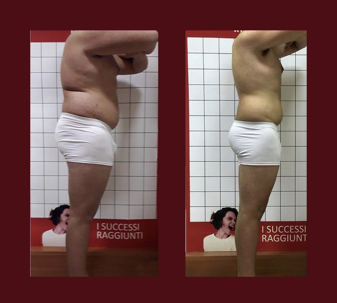 Infrabaldan before and after — profile